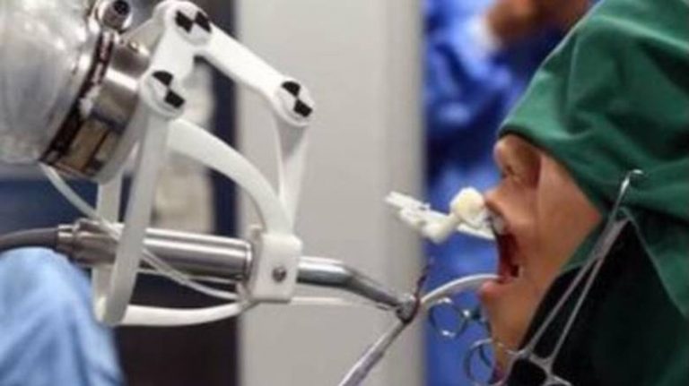 Έγινε και αυτό στην Κίνα: Ρομπότ έκανε μόνο του εμφύτευση δοντιών σε ασθενή