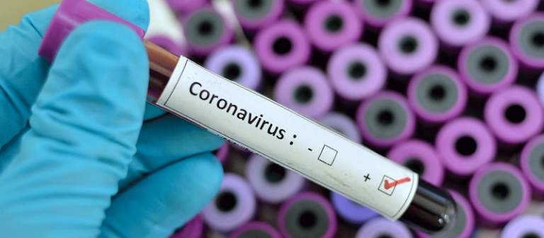 Rapid tests στο Πολιτιστικό Κέντρο Αιγίου «Αλέκος Μέγαρης» με πρωτοβουλία της ΔΗ.Κ.Ε.Π.Α.